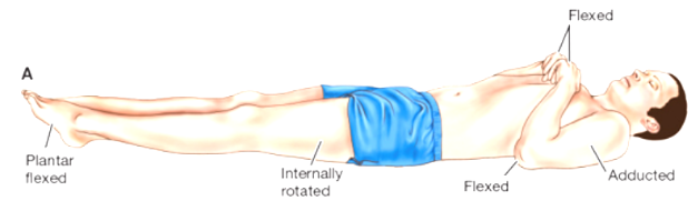 <p><span style="line-height: 20.5042px;"><strong>i</strong>nvolves abnormal flexion of the upper extremities and extension of the lower extremities and<strong> indicates damage to the upper midbrain</strong></span></p>