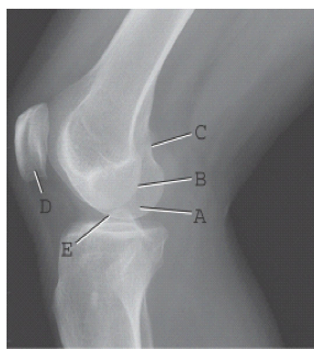<p>A</p>