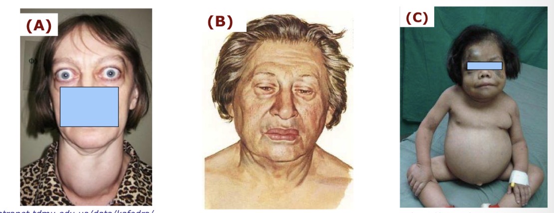 <p>A</p>
