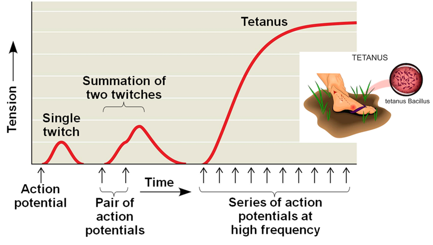 <p>Tetanus</p>
