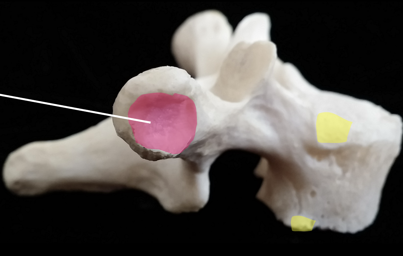 <p>From the lateral view, what is the yellow region highlighted on the thoracic vertebrae?</p>