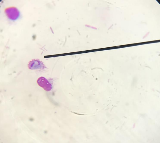 <p>Identifique e nomeie 4 sintomas da doença</p>
