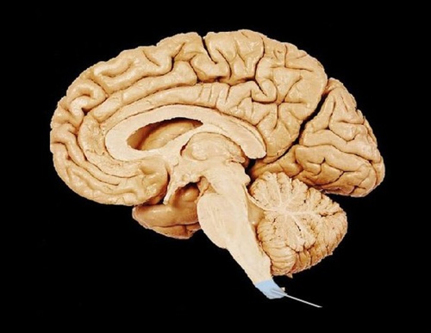 <p>The bundle of nerve fibers connecting the brain to the rest of the body.</p>
