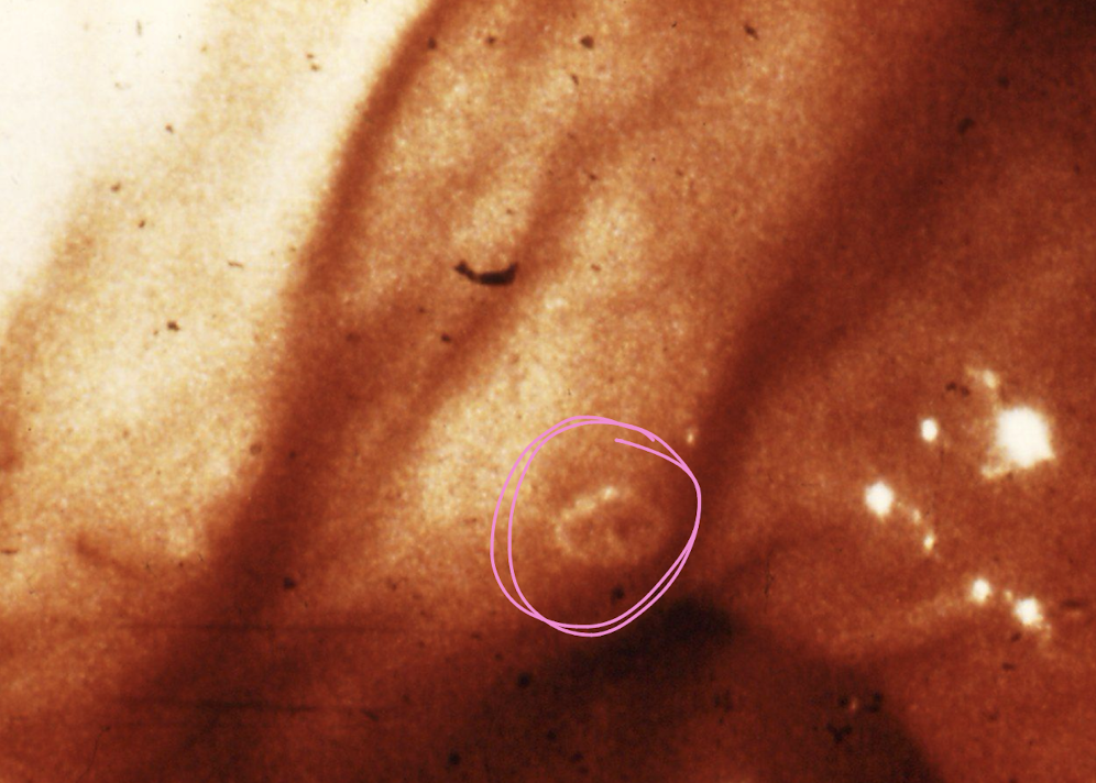<p>what helminth is this?</p>