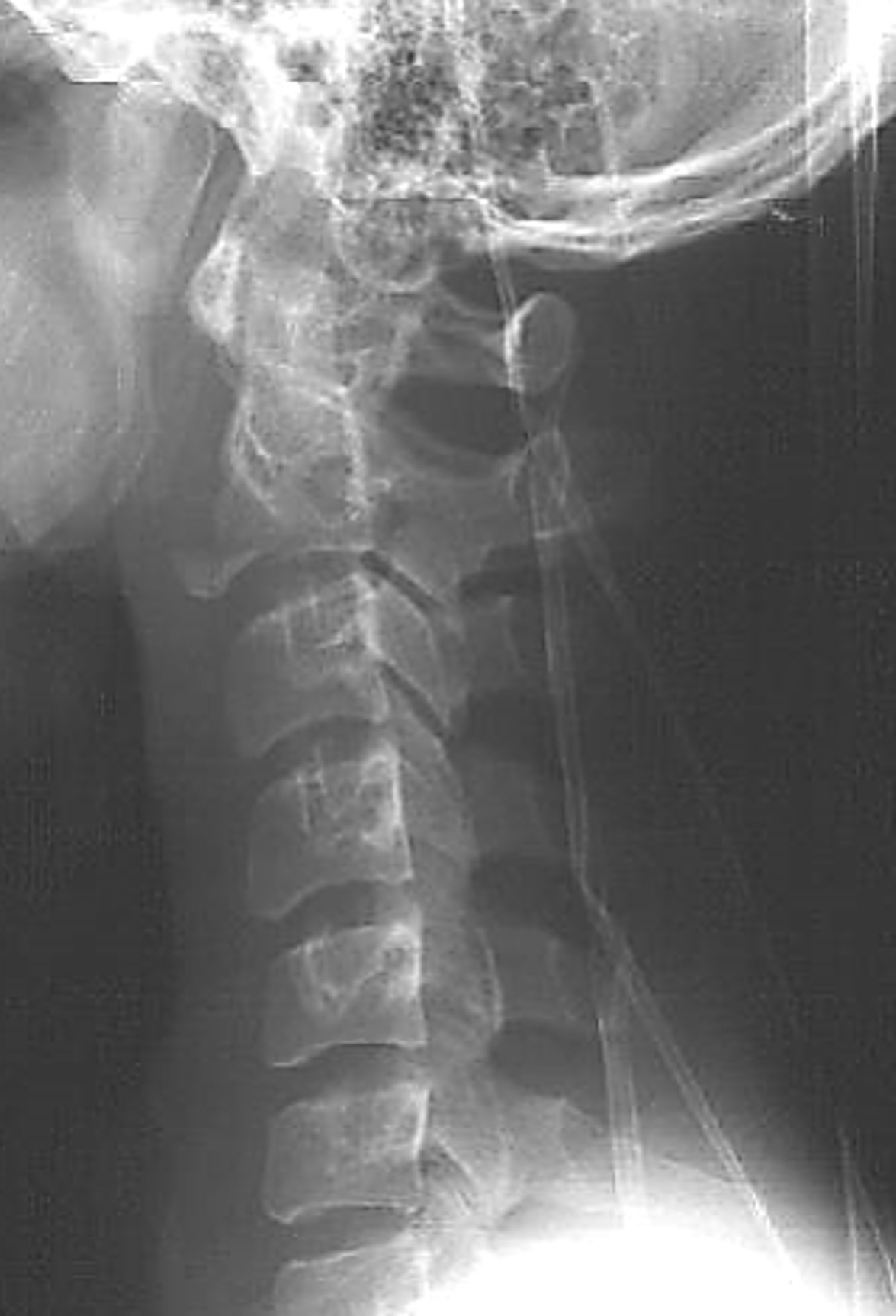 <p>What is the likely diagnosis?</p>