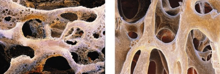 <p>What is the pathology?</p>