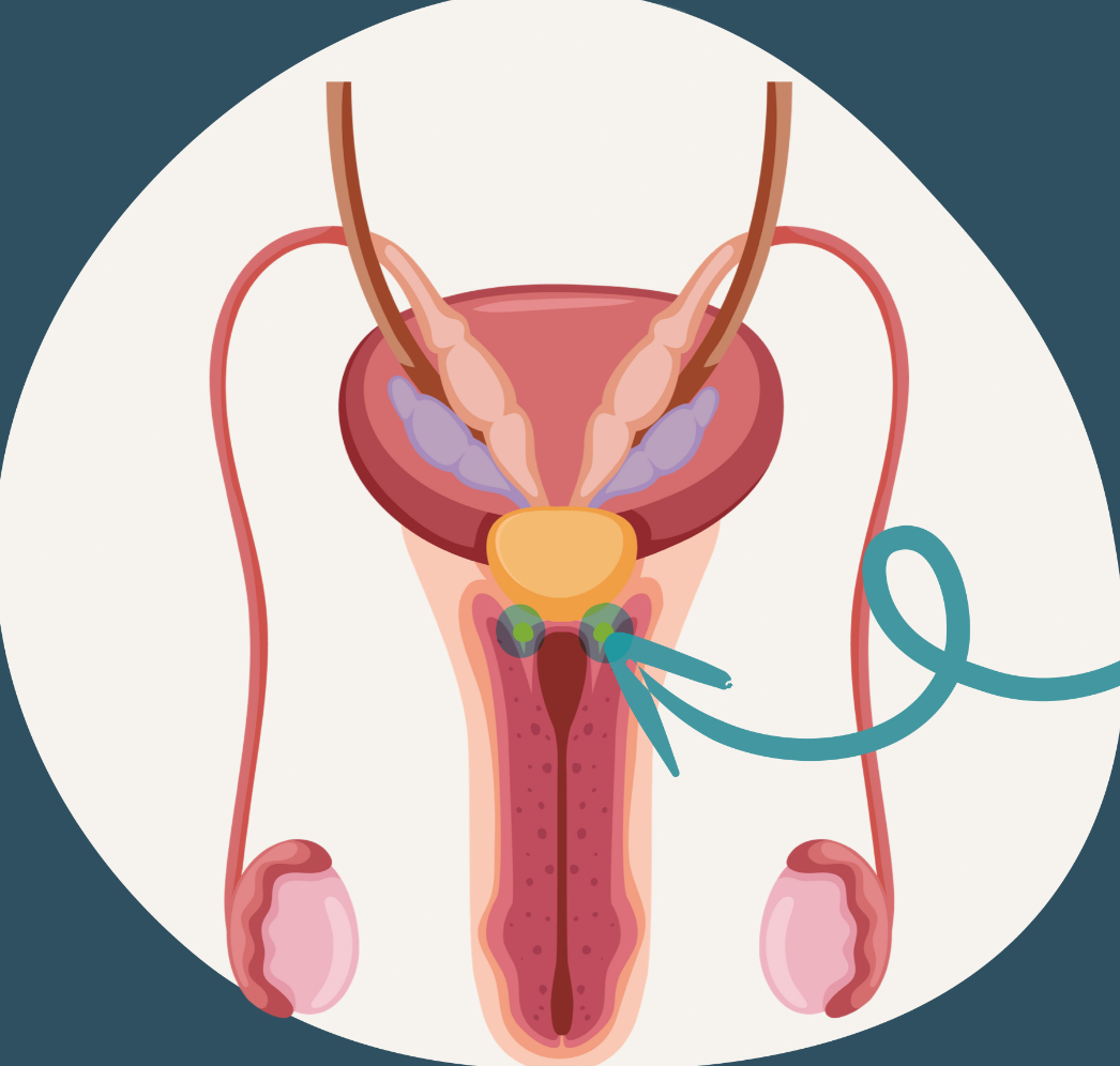 <p>also called the bulbourethral gland, one of the two pea-sized organs found beneath the prostate gland</p><ul><li><p>responsible for releasing fluid that flushes out foreign matter, lubricates, and neutralizes any acid in the urethra so the sperm will be safe and able to pass through freely</p><ul><li><p>ensures sperm doesn’t mix with urine</p></li></ul></li></ul><p></p>