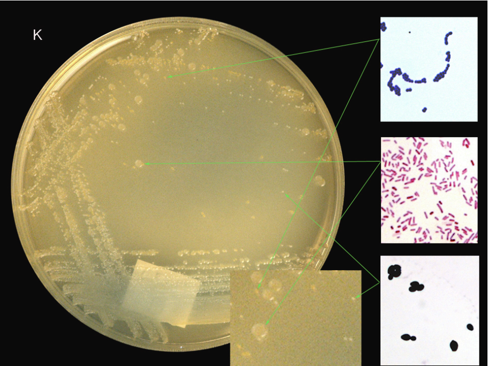 <p>PLATE K: </p><p>Candida albicans </p><p>E. coli </p><p>Ent. faecalis </p><p>Three colonies are present. On CLED, E.coli is confirmed by the creamy-yellow pH reaction, Ent faecalis is confirmed as bright yellow, the third matt-white colony is C.albicans which does not ferment lactose and so does not cause a pH change.</p>