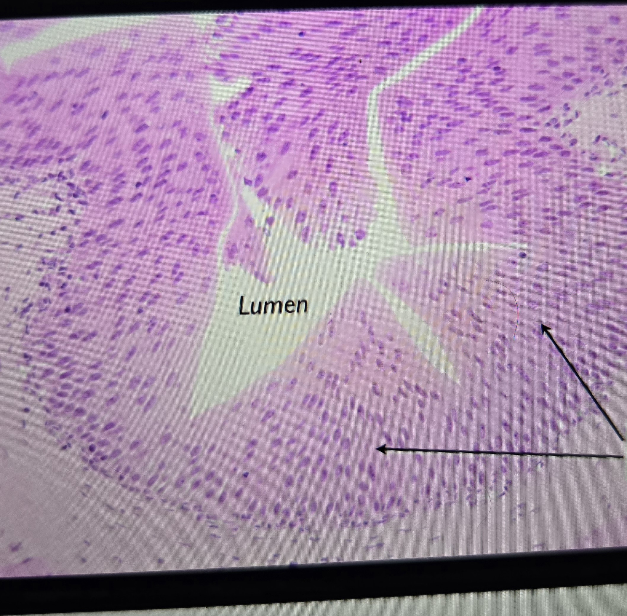 term image