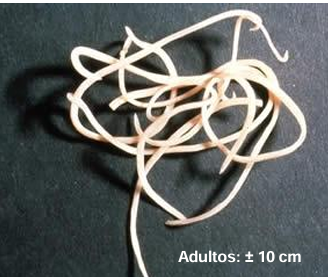 <p>Ciclo evolutivo <em>Toxocara canis</em> </p>