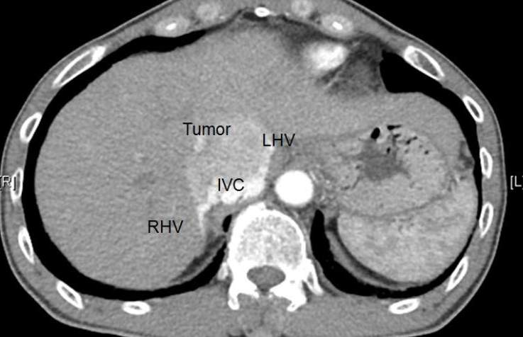 <p>Which of the following matches with the findings below?</p>