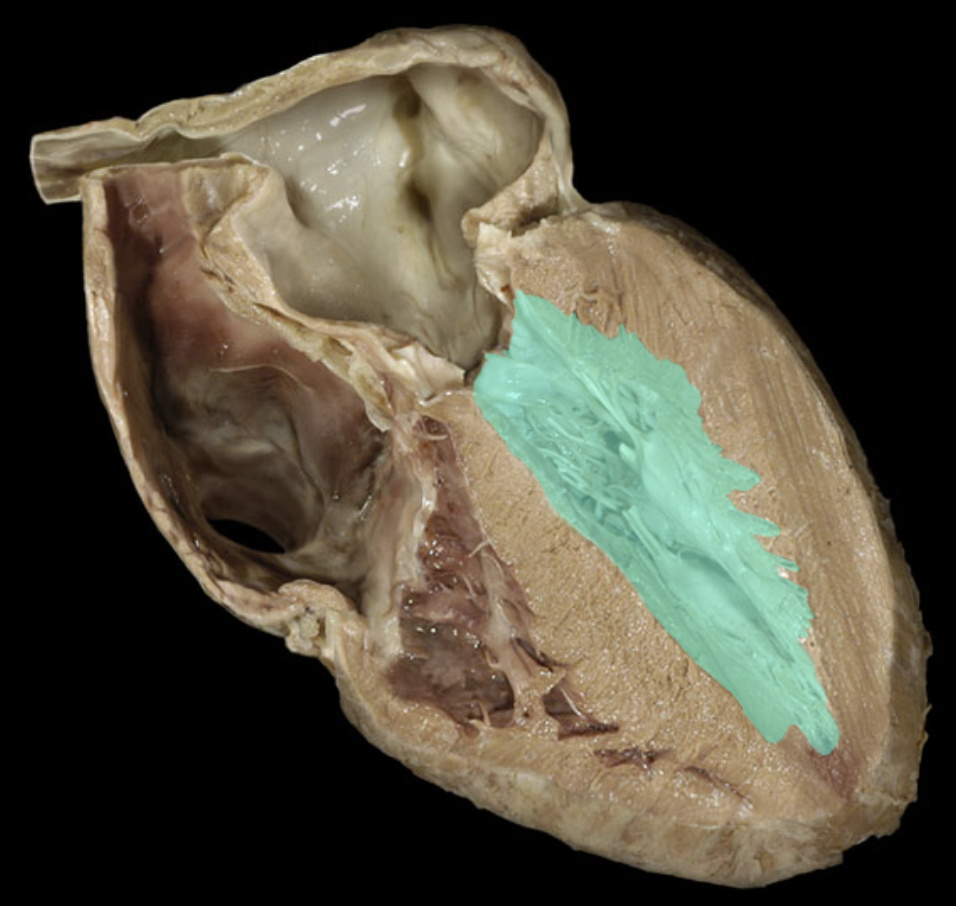 <p>Identify the feature of the heart</p>