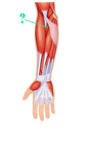 <p>Identify the indicated muscle</p>
