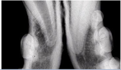 <p>Which side is normal? Abnormal? Describe what you are looking at</p>