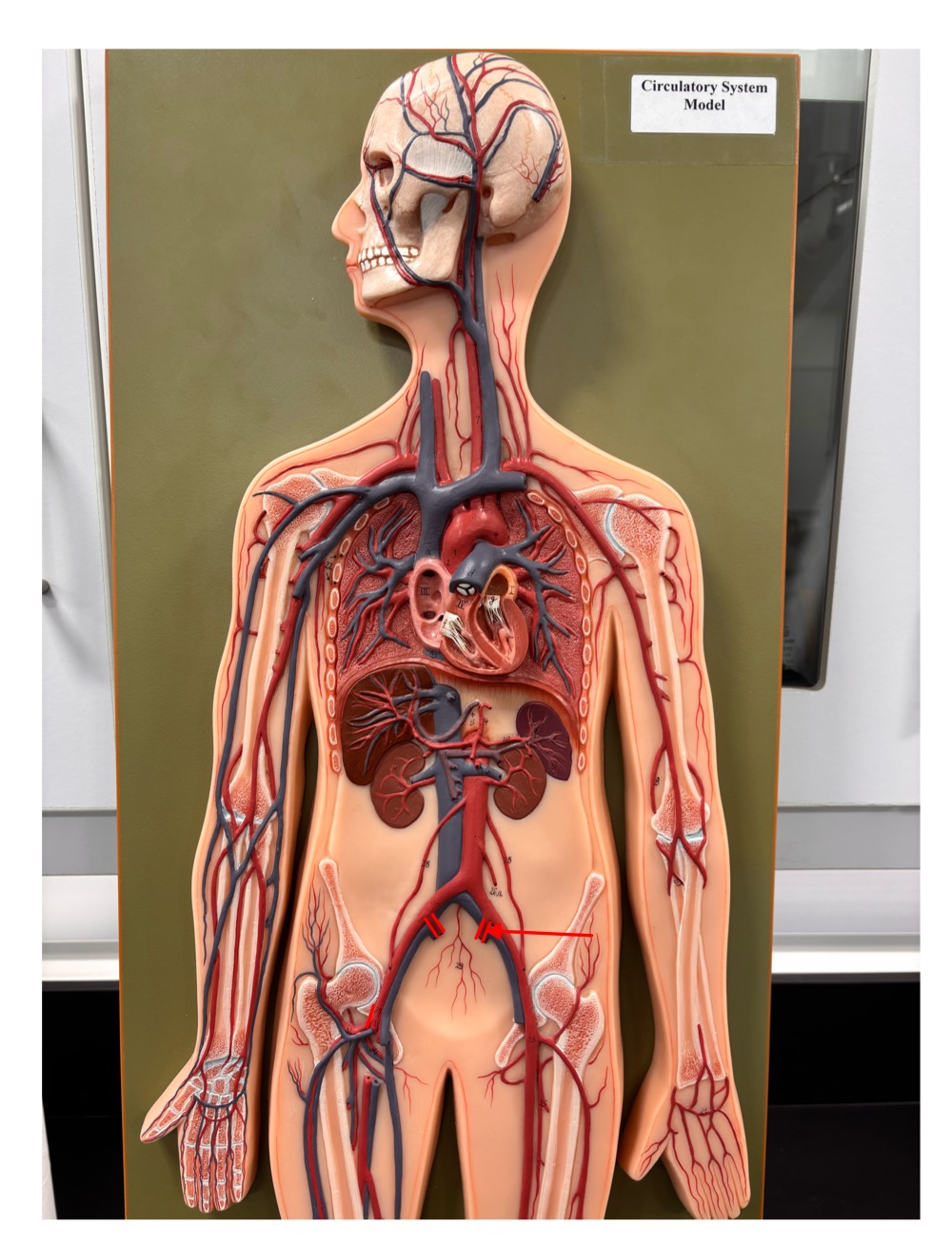 <p>name the blood vessel</p>