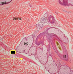 <p>Identify the structure</p><img src="https://assets.knowt.com/user-attachments/10686cfa-3526-4583-8798-744caa1bd5ac.png" data-width="50%" data-align="center" alt="knowt flashcard image" style="display: block; width: 50%; margin-left: auto; margin-right: auto;"><p></p>