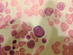 <p>12-17 um</p><p>N:C ratio 6:1</p><p>Chromatin is coarser with slightly visible parachromatin</p><p>Nucleoli not visible</p><p>Normally confined to bone marrow.</p>