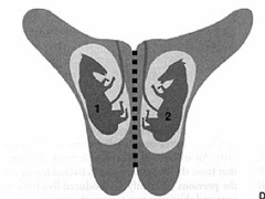 <p>Describe this pregnancy</p>