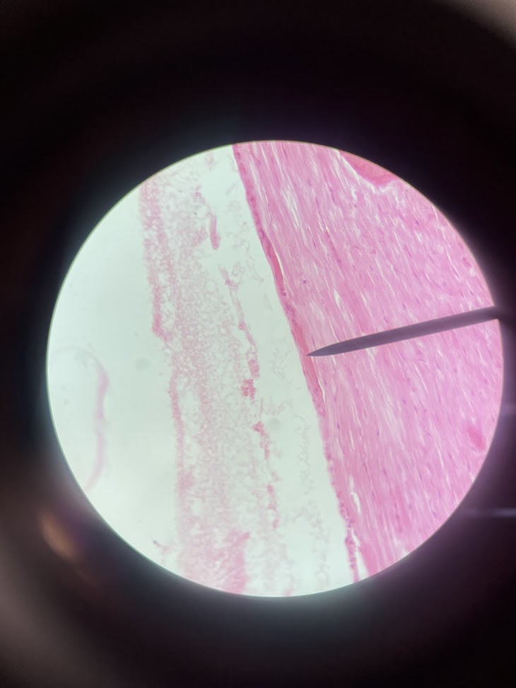 <p>structure name + layer name</p>