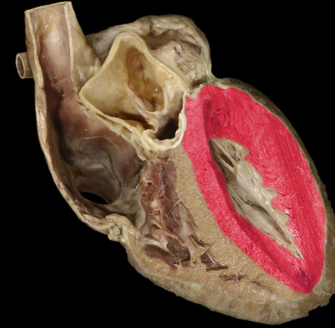 term image