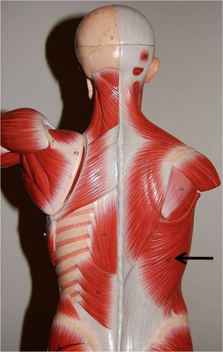 <p>What muscle is this?</p>