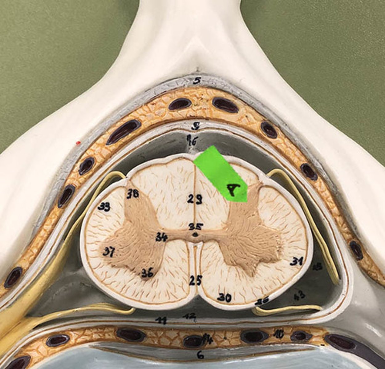 <p>Identify this structure (be specific).</p>