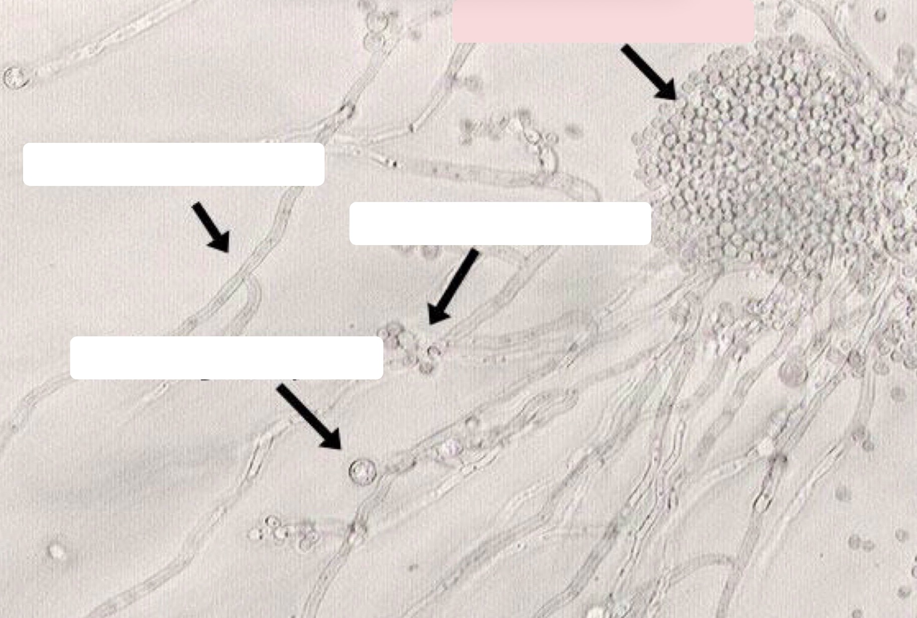 <p>Identify the C. albican Structure </p>