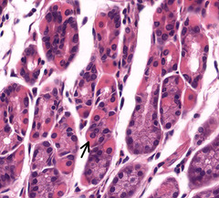 <p>What organelle causes the cytoplasm of this parietal cell to stain eosinophilic?</p>
