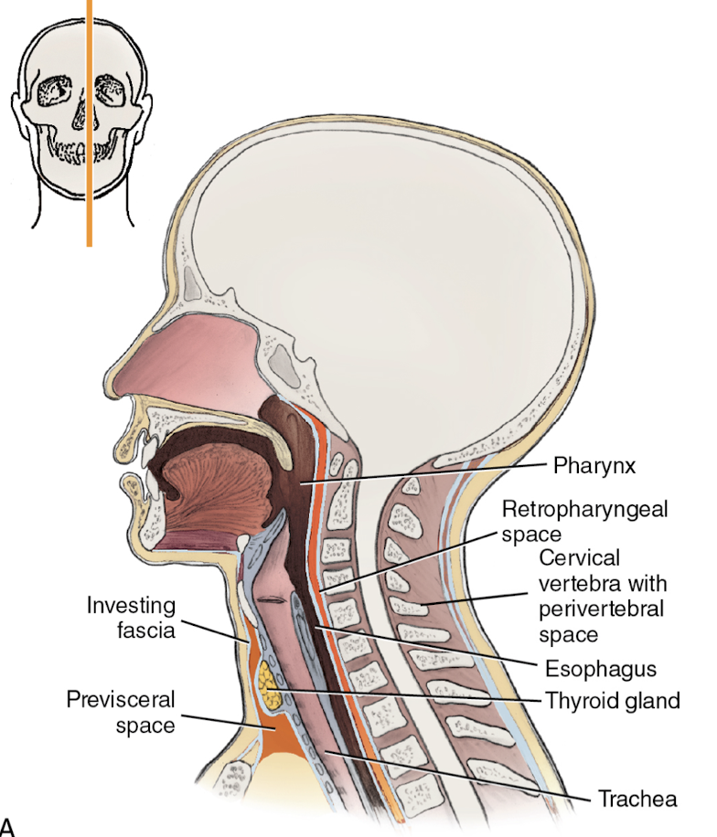 <p>What is this photo an example of?</p>