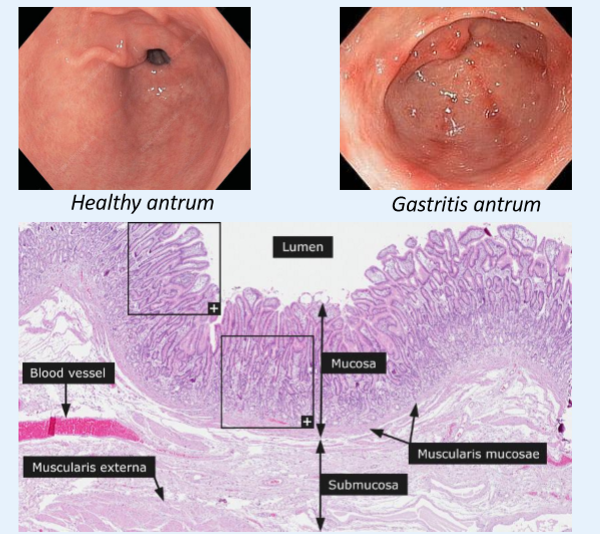 <img src="https://assets.knowt.com/user-attachments/aacc60a6-ec52-4ed0-b5cc-56ac9ca460cb.png" data-width="75%" data-align="center" alt="knowt flashcard image"><p></p>