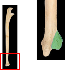<p>rounded distal end of ulna</p>
