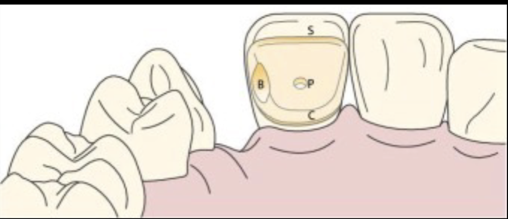 <p>the minimum zirconia ceramic dimensions of the proximal connect were <strong> mm horizontally x </strong>__ mm vertically </p>