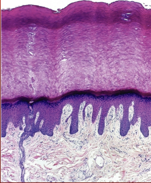 <p>What are the ridges on the dermal papillae (downward projections)?</p>