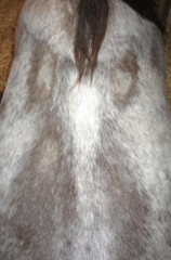 <p>What are causes of white hair or alopecia?</p>