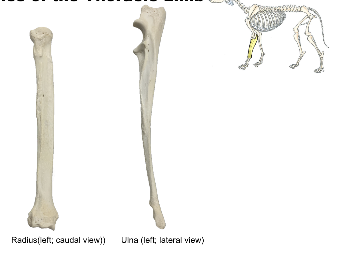 <p>Radius</p><p>Ulna</p>