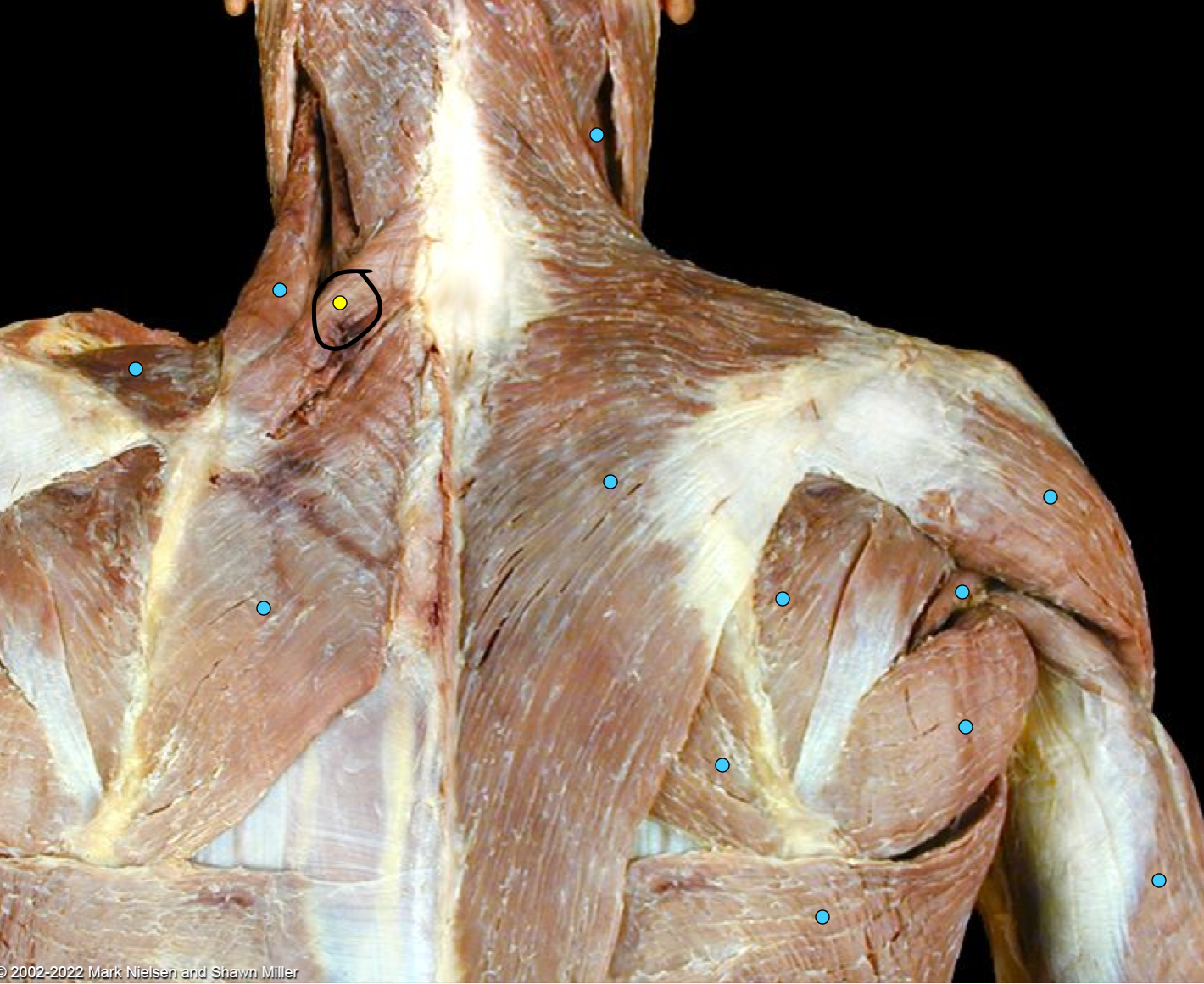 term image