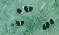 <p>Tipo de tejido cartilaginoso</p>