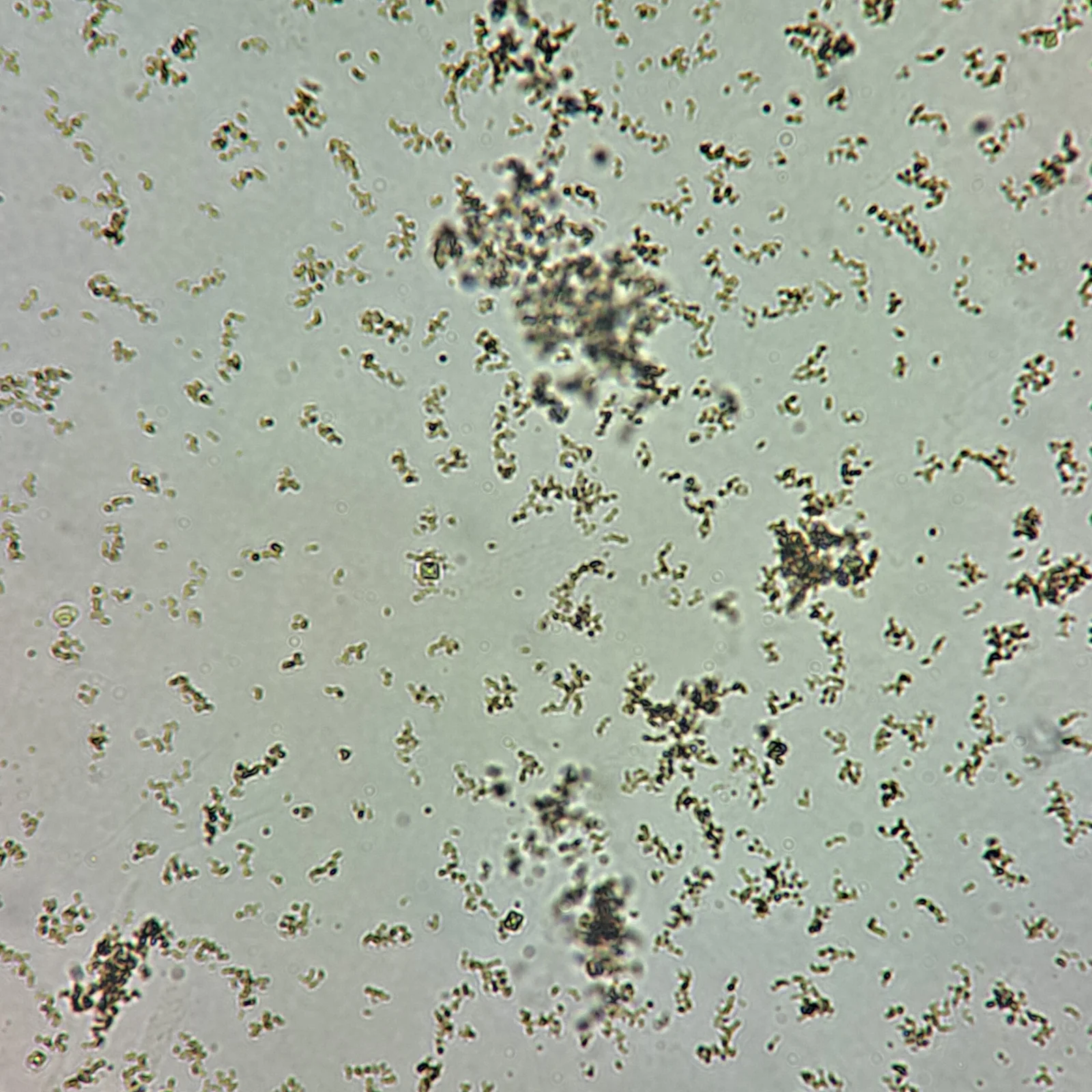 <p>Acidic Urine, what is this?</p>