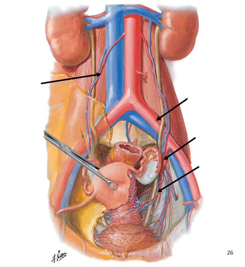 <p>Label the following diagram of the <strong>vascular supply</strong> of the female reproductive system</p>