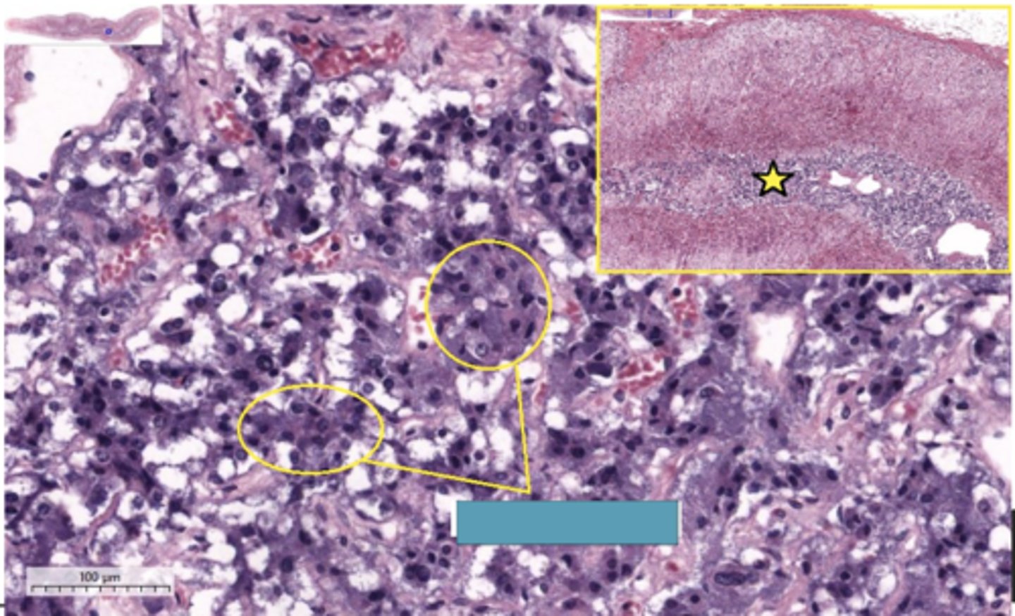 <p>Identify the cells</p>