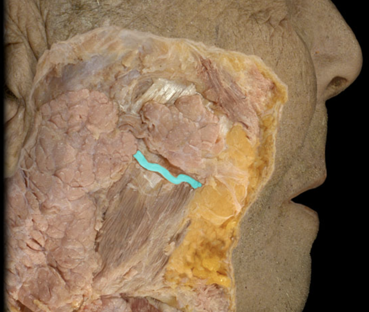 term image