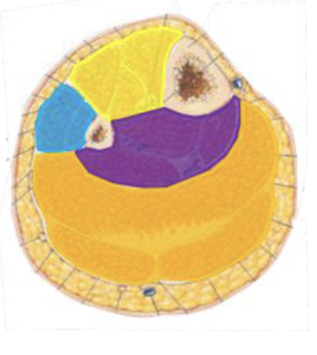 <p>What are the four compartments of the lower leg (label each color)</p>