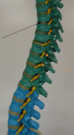 <p>What are these called that are in between each vertebra (dark green)? </p>