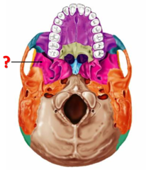 <p>Identify this bone.</p>