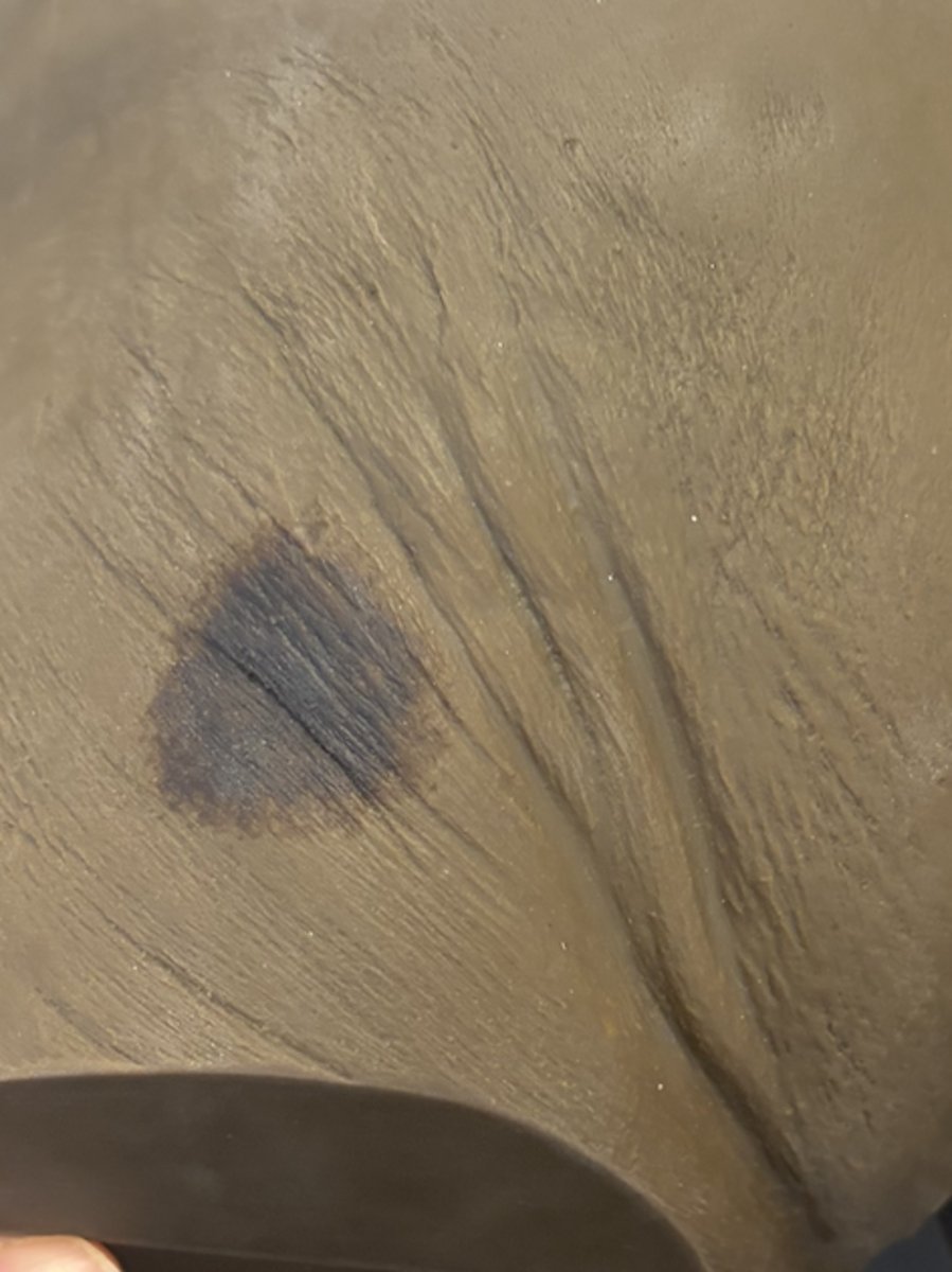 <p>what wound is this and how do you care for it?</p>