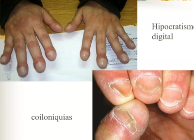 <p>¿que tipo de patología esta asociada?</p>