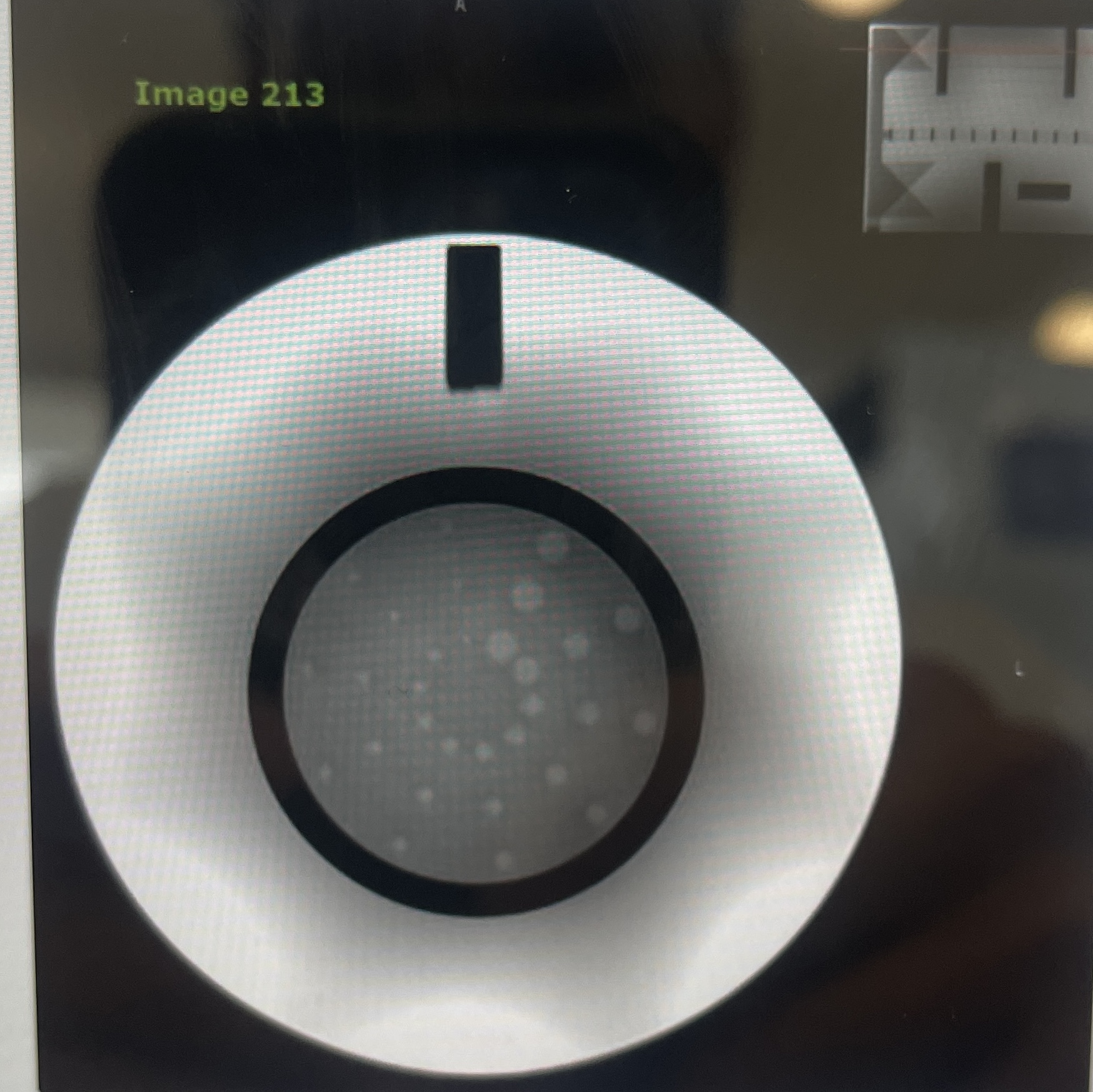 <p>When acquiring ACR QA data, the slice correlating to image 213 requires what visual discernment?</p>