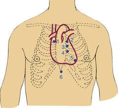 <p>5 (see image)</p><p>CH. 30</p>
