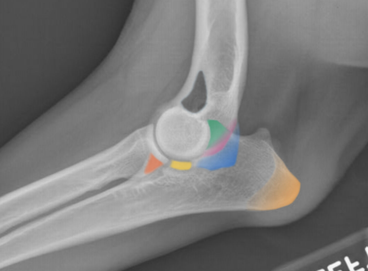 <p>(Ca.) Forelimb: Describe Structures of the Cubiti (“Elbow”)</p>
