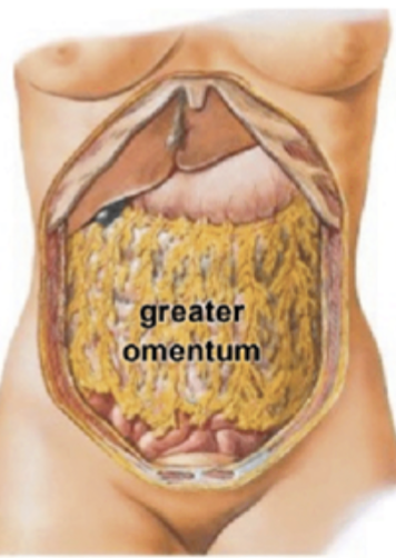 <p><strong>greater omentum</strong></p>